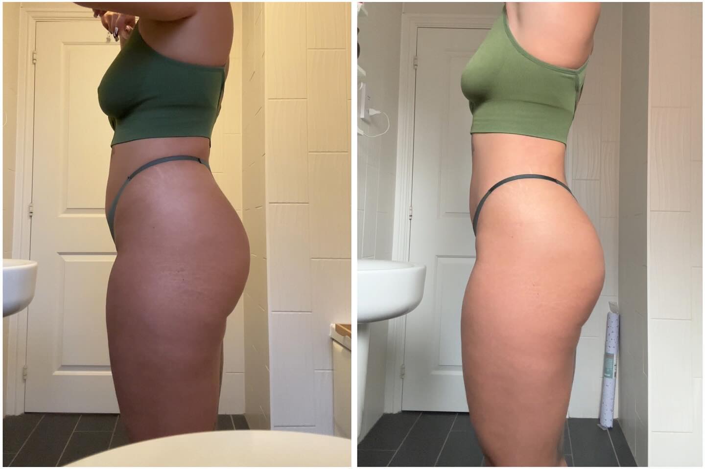 ✨12 Week Transformation✨ 

January 1st I made the decision after not long coming back from a 2 week all inclusive🐷 that I wasn’t happy with myself (who is🤷🏻‍♀️) and went into a 3 day fast straight into keto where I dropped most of the body fat. 

After getting to a point where I was happy with the way things were going but didn’t necessarily want to loose loads more fat (Mainly because you can’t spot reduce and I was worried I’d loose weight in places I didn’t want to lose, eg ass😂) I decided that now I wanted to focus a bit more on form and strength. 

Now you’d think I would have struggled more loosing the weight but now I’m trying to force myself to eat more as I’ve now entered a lean bulk phase which mentally is challenging as to me eating more = getting fat so I’m trying my hardest to get out of that mindset🙄 So here we are, 9 weeks cut and now 3 weeks into a lean - ish bulk to gain some muscle mass and strength💪🏽😌 Let’s see what else I can achieve in another 12 weeks for summer⛅️